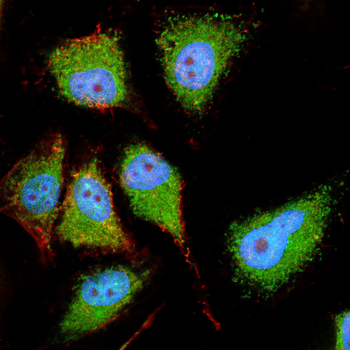 Phospho-Akt (Ser473) Rabbit Polyclonal Antibody