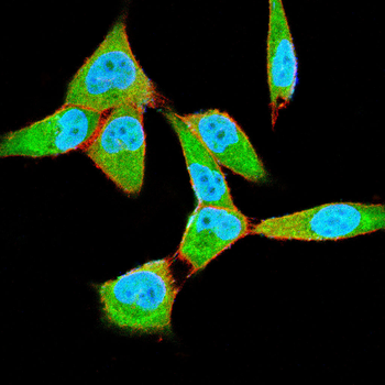 Phospho-Akt (Ser473) Rabbit Polyclonal Antibody