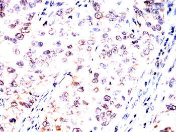 HDAC10 Antibody