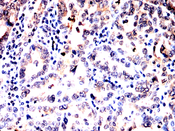 HDAC10 Antibody