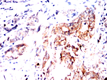 NME2 Antibody