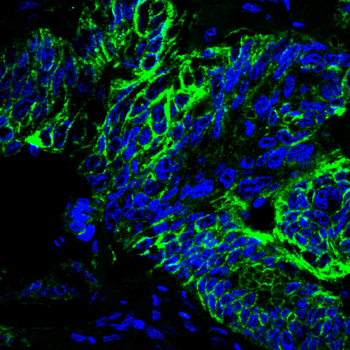 CDH17 Antibody