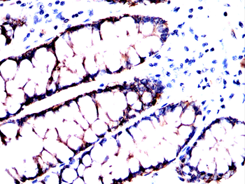 CDH17 Antibody