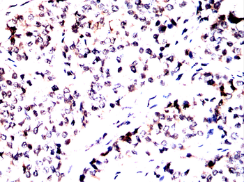 WTAP Antibody