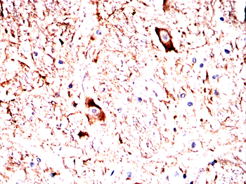 TUBB Antibody