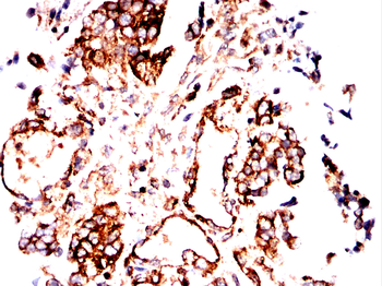 TUBB Antibody
