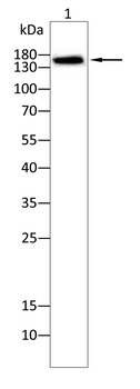 KDM5B Antibody