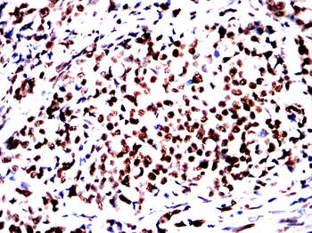 CBX1 Antibody