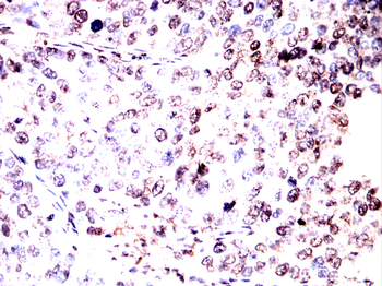 CBX1 Antibody