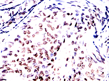 CBX1 Antibody