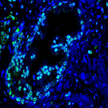 CBX1 Antibody