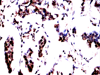 PARP1 Antibody