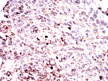 PARP1 Antibody