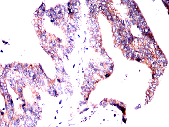 MDM2 Antibody