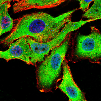 MDM2 Antibody