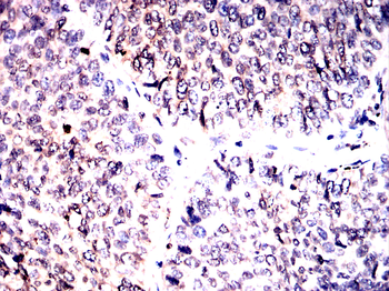 CALR Antibody
