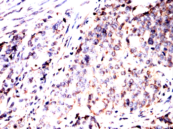 CALR Antibody