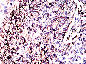 CALR Antibody