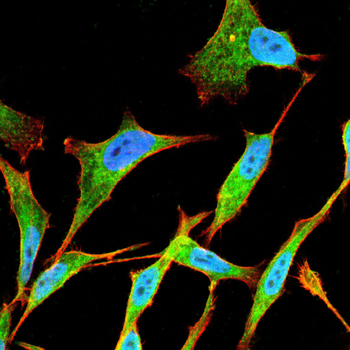 TH Antibody
