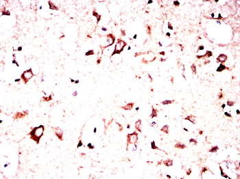 TH Antibody