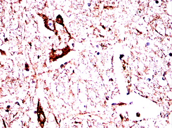TH Antibody