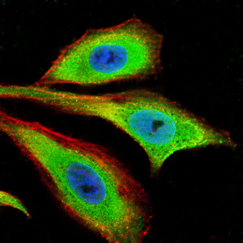 Myeloperoxidase Rabbit Polyclonal Antibody