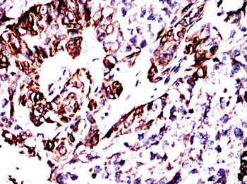 ANXA2 Antibody
