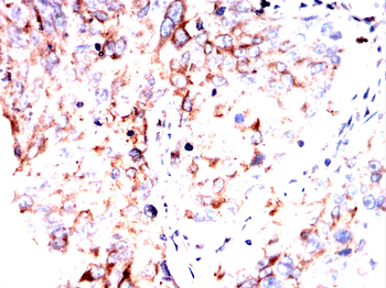 ACTN4 Antibody