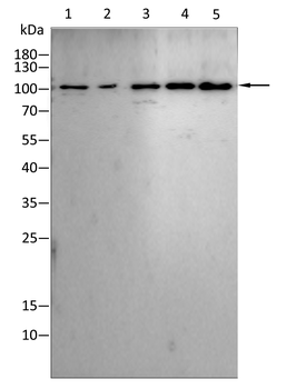 ACTN4 Antibody