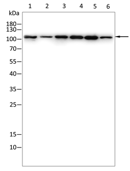 ACTN4 Antibody
