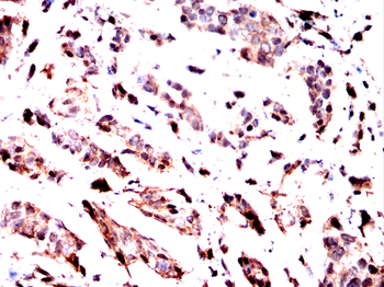 ACTN4 Antibody