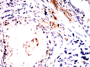 SYNPO Antibody
