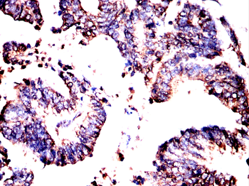 PLCG1 Antibody