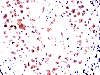 TREX1 Antibody