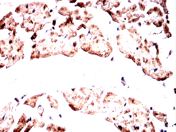 CAMK2A Antibody