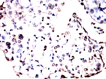 CAMK2A Antibody