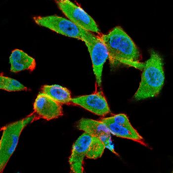 ESR1 Antibody