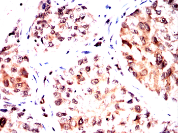 ESR1 Antibody
