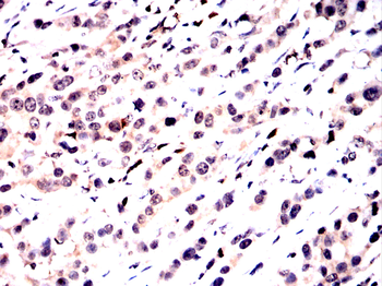 ESR1 Antibody