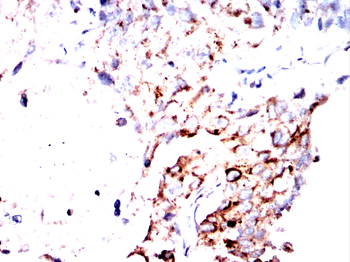 OGT Antibody