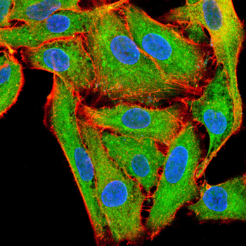 OGT Antibody