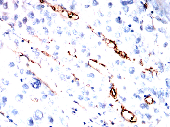 KDR Antibody