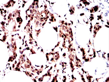 NF2 Antibody