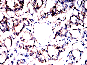 NF2 Antibody