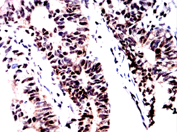 NF2 Antibody