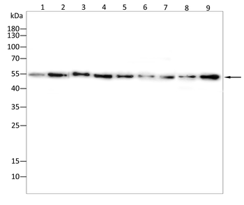 SSTR2 Antibody