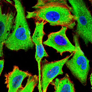 SSTR2 Antibody