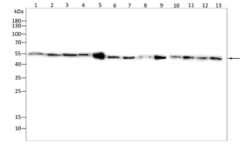SSTR2 Antibody