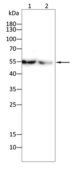 SSTR2 Antibody
