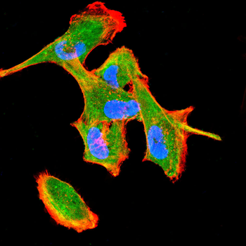HDAC4 Antibody
